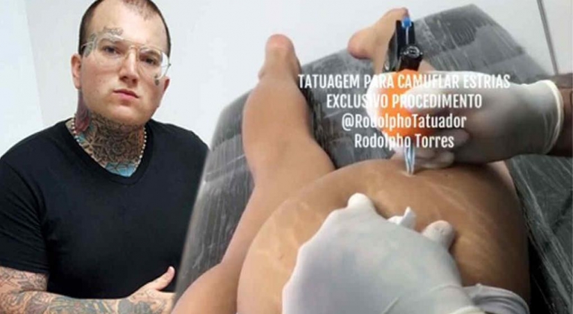 En lugar de cirujanos y cremas: un tatuador brasileño se deshace de las estrías de una manera poco convencional