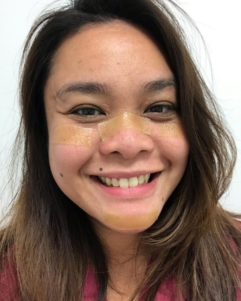 "Estas heridas no desaparecerán, permanecerán dentro de nosotros": fotos de chicas médicas con rastros de máscaras en sus rostros