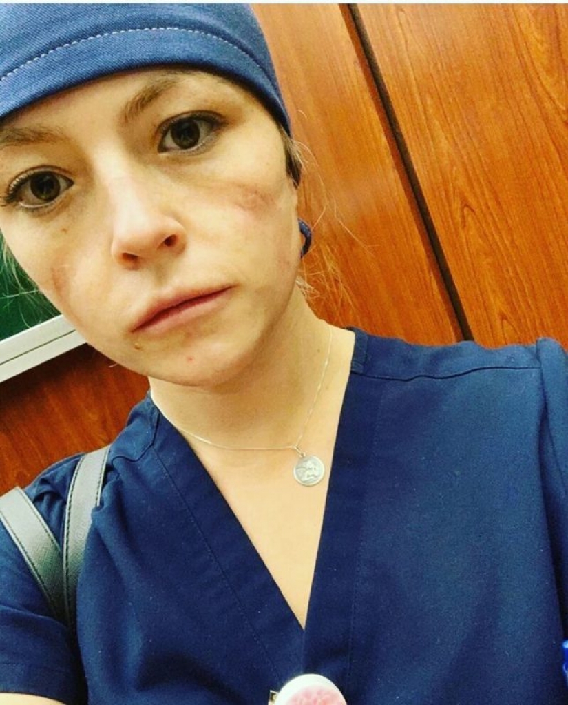 "Estas heridas no desaparecerán, permanecerán dentro de nosotros": fotos de chicas médicas con rastros de máscaras en sus rostros