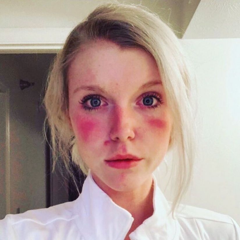 "Estas heridas no desaparecerán, permanecerán dentro de nosotros": fotos de chicas médicas con rastros de máscaras en sus rostros