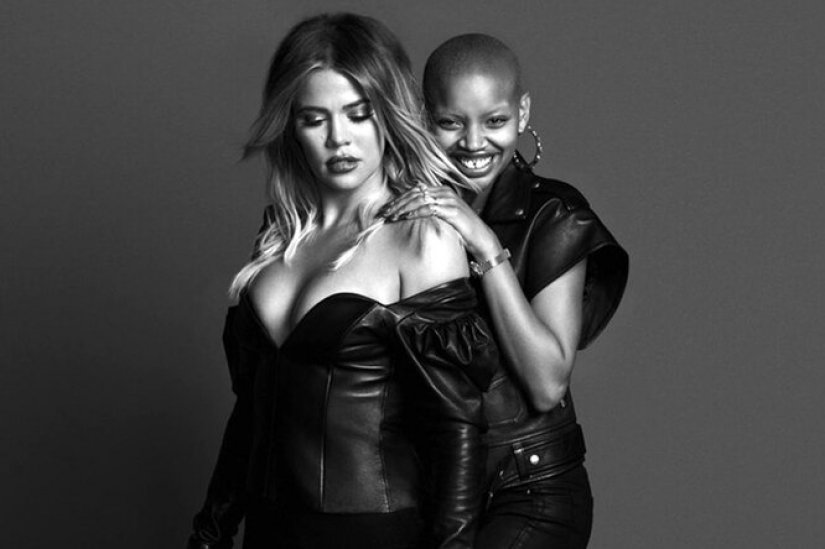 Estrabismo, albinismo, edad: 5 modelos que rasgan la plantilla de belleza Estrabismo, albinismo, edad: 5 modelos que rasgan la plantilla de belleza