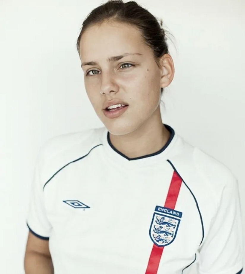 Estrabismo, albinismo, edad: 5 modelos que rasgan la plantilla de belleza Estrabismo, albinismo, edad: 5 modelos que rasgan la plantilla de belleza