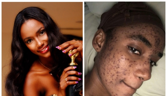 Fatal care: the model claims that Swiss cosmetics ruined her skin and career Fatal care: the model claims that Swiss cosmetics ruined her skin and career