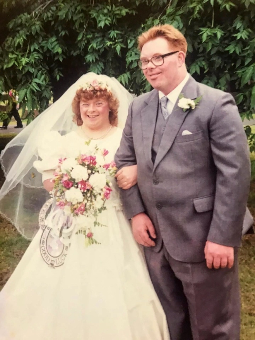 For better or for worse: spouses with Down syndrome celebrated their 28th wedding anniversary