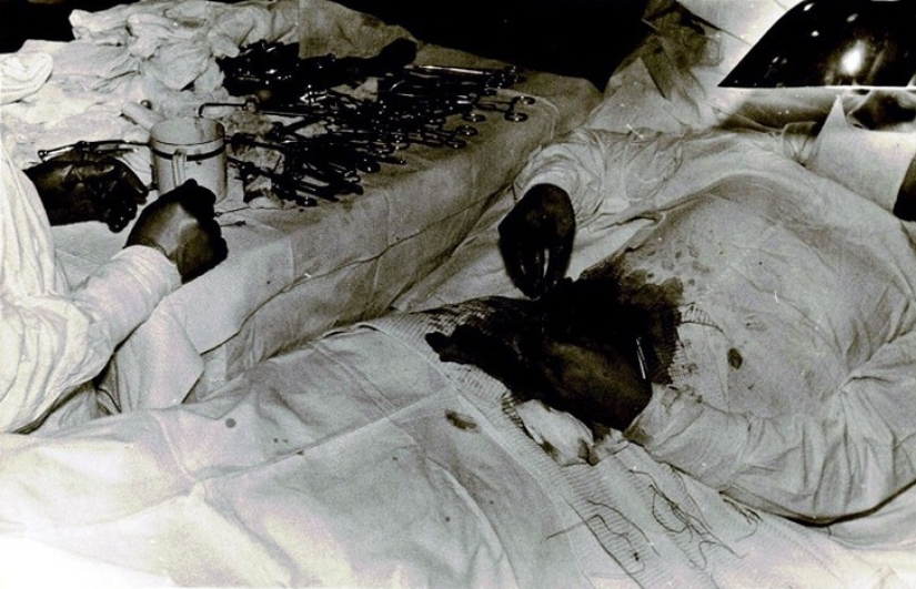 Fortaleza y coraje increíbles: cómo un médico ruso se operó a sí mismo