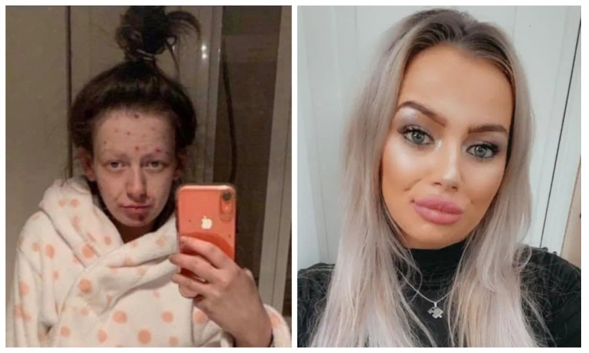 From a frog to a princess: a former drug addict became a beauty, getting rid of addiction From a frog to a princess: a former drug addict became a beauty, getting rid of addiction