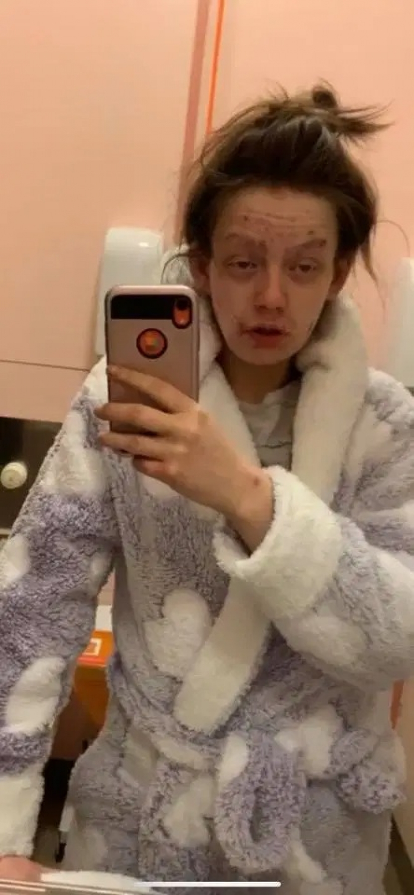 From a frog to a princess: a former drug addict became a beauty, getting rid of addiction From a frog to a princess: a former drug addict became a beauty, getting rid of addiction