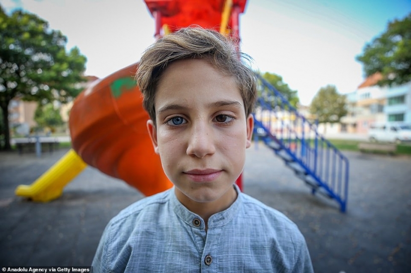 Genes multicolores: los hermanos de Turquía con heterocromía rara fascinan a primera vista