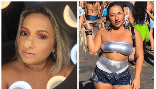 "Go away, Pinocchio!": a Brazilian woman has learned to love herself, despite a huge nose