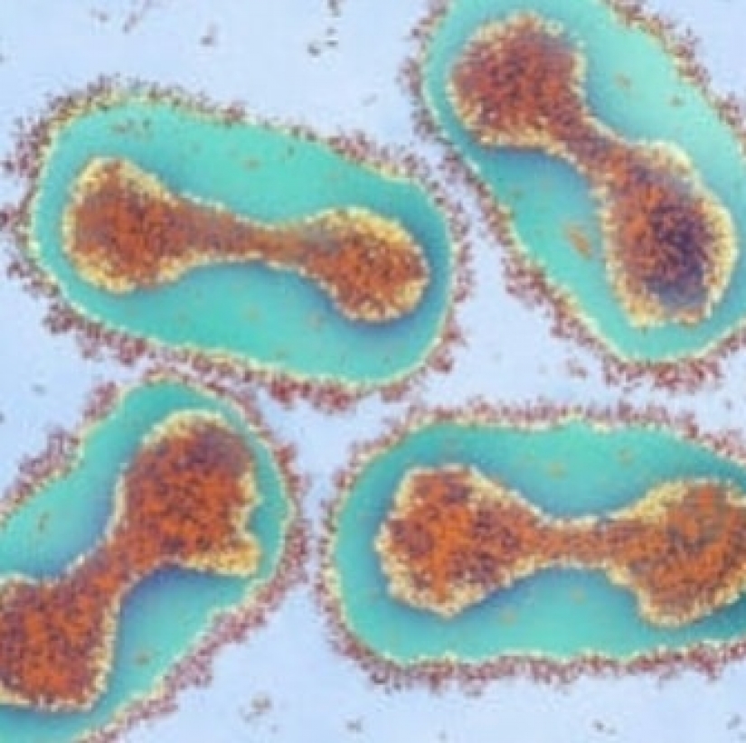 La belleza dentro de: un microbiólogo de la Ufa muestra en instagram los virus y bacterias que viven en nosotros