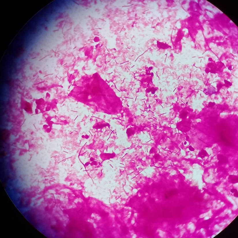 La belleza dentro de: un microbiólogo de la Ufa muestra en instagram los virus y bacterias que viven en nosotros