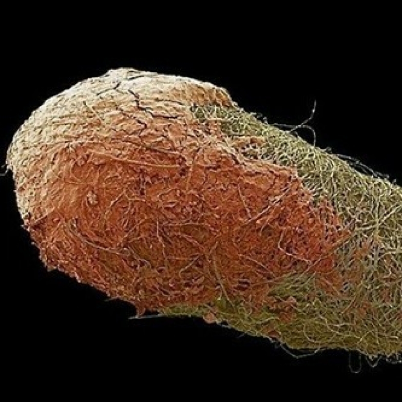 La belleza dentro de: un microbiólogo de la Ufa muestra en instagram los virus y bacterias que viven en nosotros