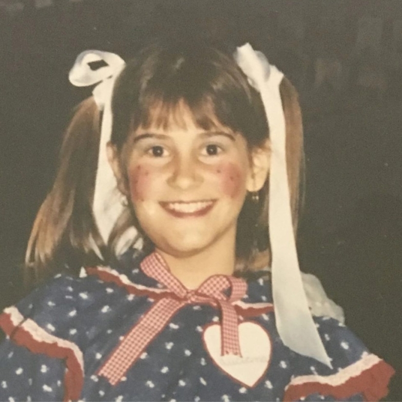 La belleza, no importa qué: una mujer Brasileña con una enfermedad rara admira la auto-confianza