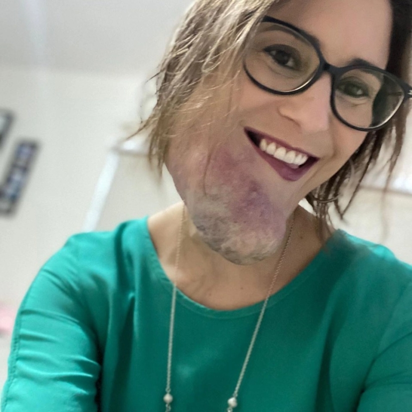 La belleza, no importa qué: una mujer Brasileña con una enfermedad rara admira la auto-confianza