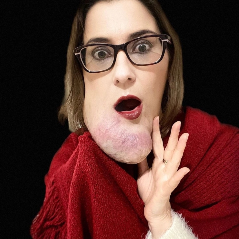 La belleza, no importa qué: una mujer Brasileña con una enfermedad rara admira la auto-confianza