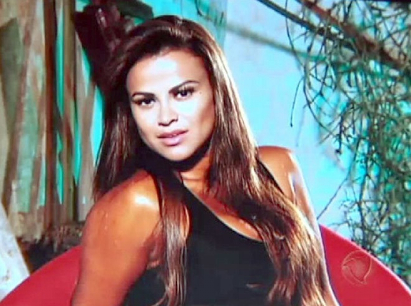 La belleza requiere: 8 víctimas de cirugía plástica La belleza requiere: 8 víctimas de cirugía plástica