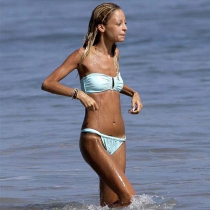 La estrella de la fiebre: el que las celebridades se enfrentan con la anorexia