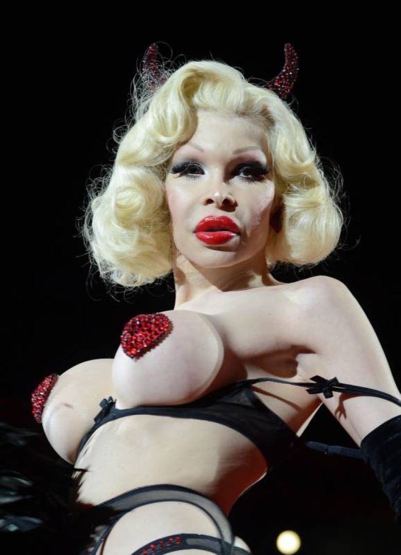 La historia de vida de Amanda Lepore, una transexual con el cuerpo más caro