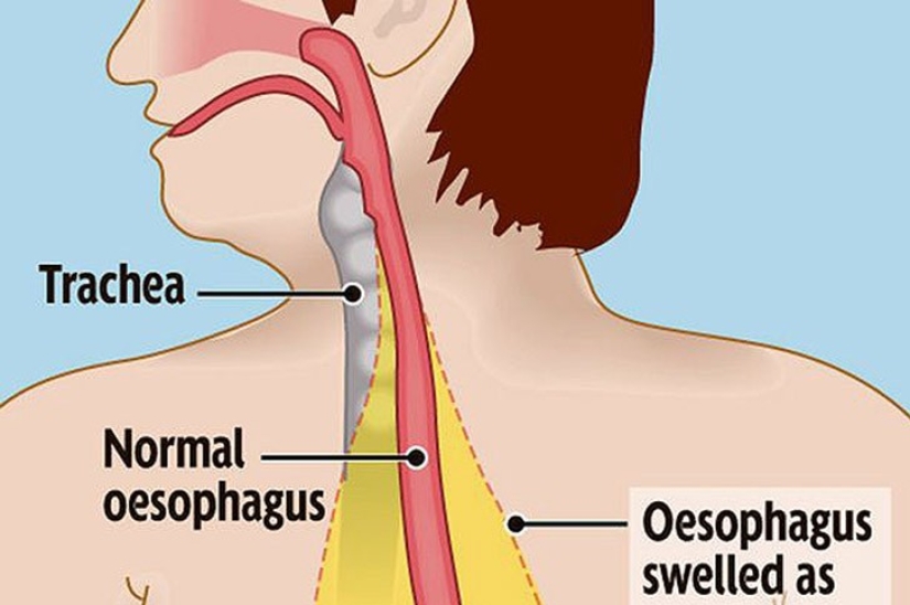 La muerte de un Petersburger tras caerse del sofá y otras muertes que causan confusión La muerte de un Petersburger tras caerse del sofá y otras muertes que causan confusión