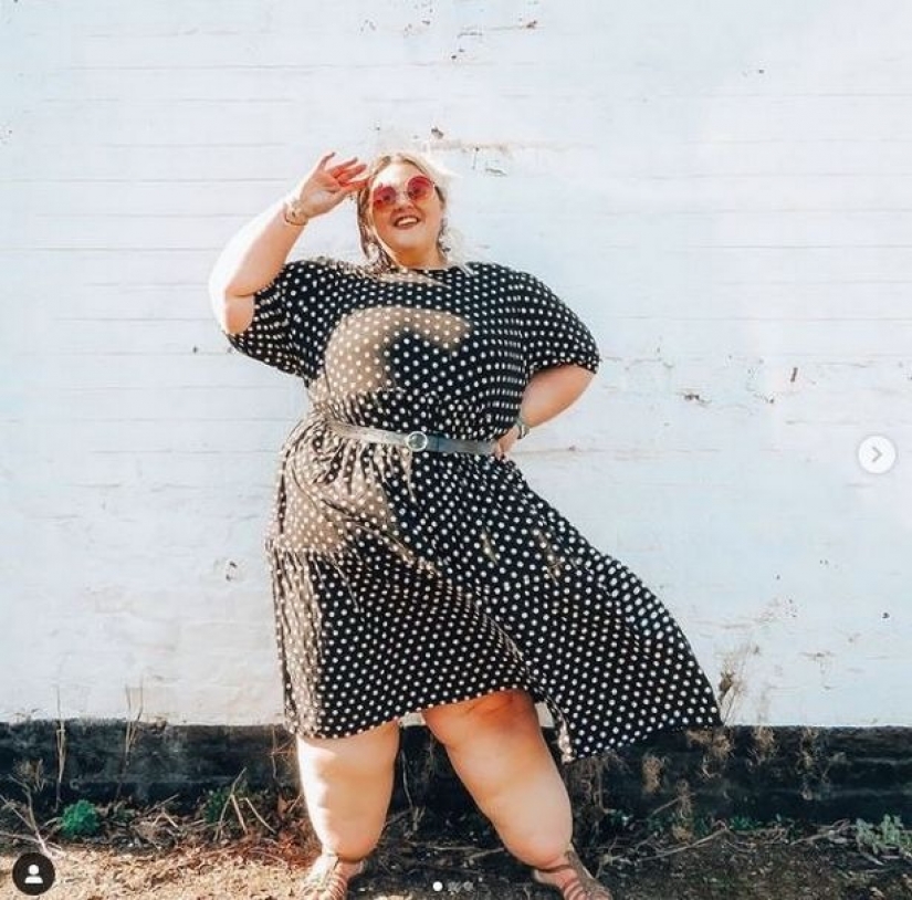 La mujer británica se agotó con dietas para hacer que sus piernas perdieran peso, pero era una enfermedad