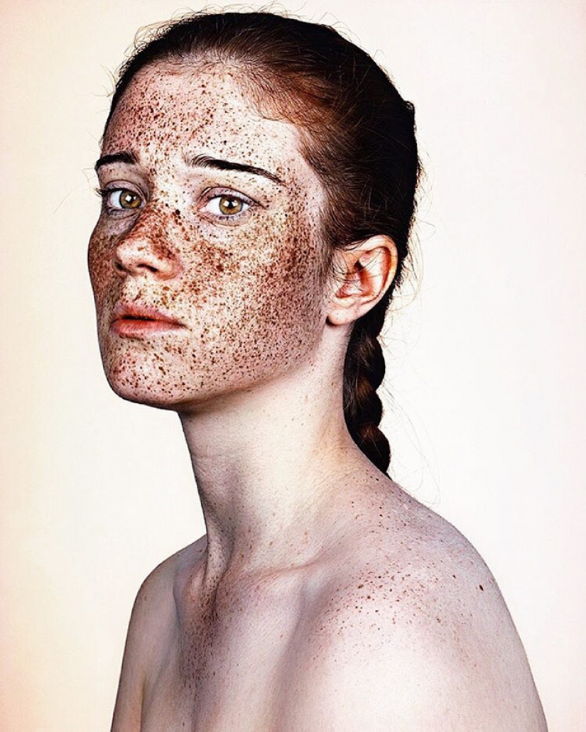 Las personas con pecas son adorables