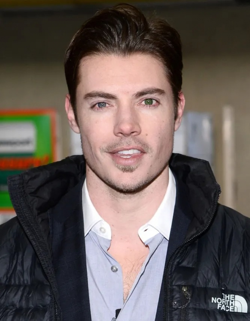 Mila Jovovich and 9 other celebrities with multicolored eyes