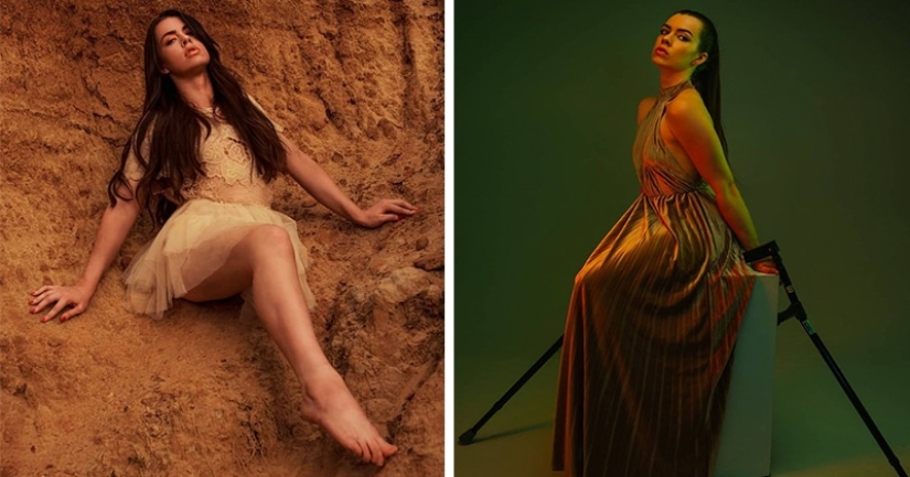 Model who lost her leg to cancer as a child is accused of simulation