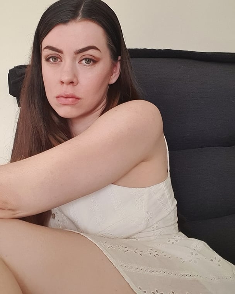 Model who lost her leg to cancer as a child is accused of simulation