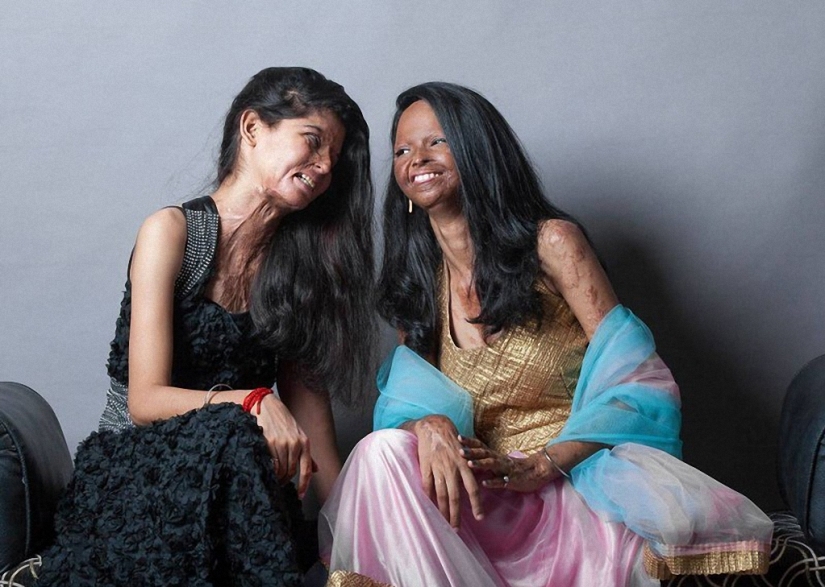 Modelos de India mutilados con ácido