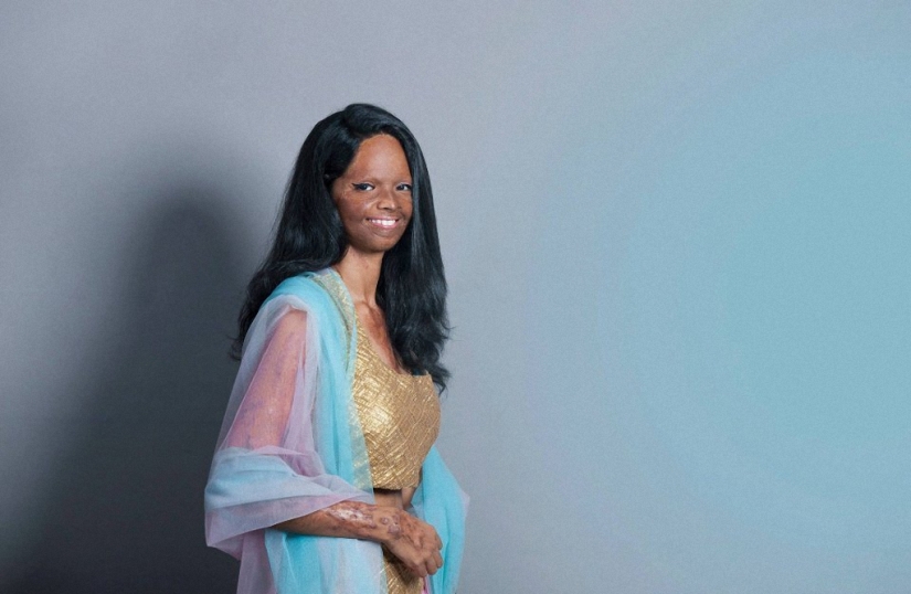 Modelos de India mutilados con ácido