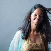 Modelos de India mutilados con ácido