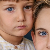 Multicolored genes: brothers from Turkey with rare heterochromia fascinate at first sight