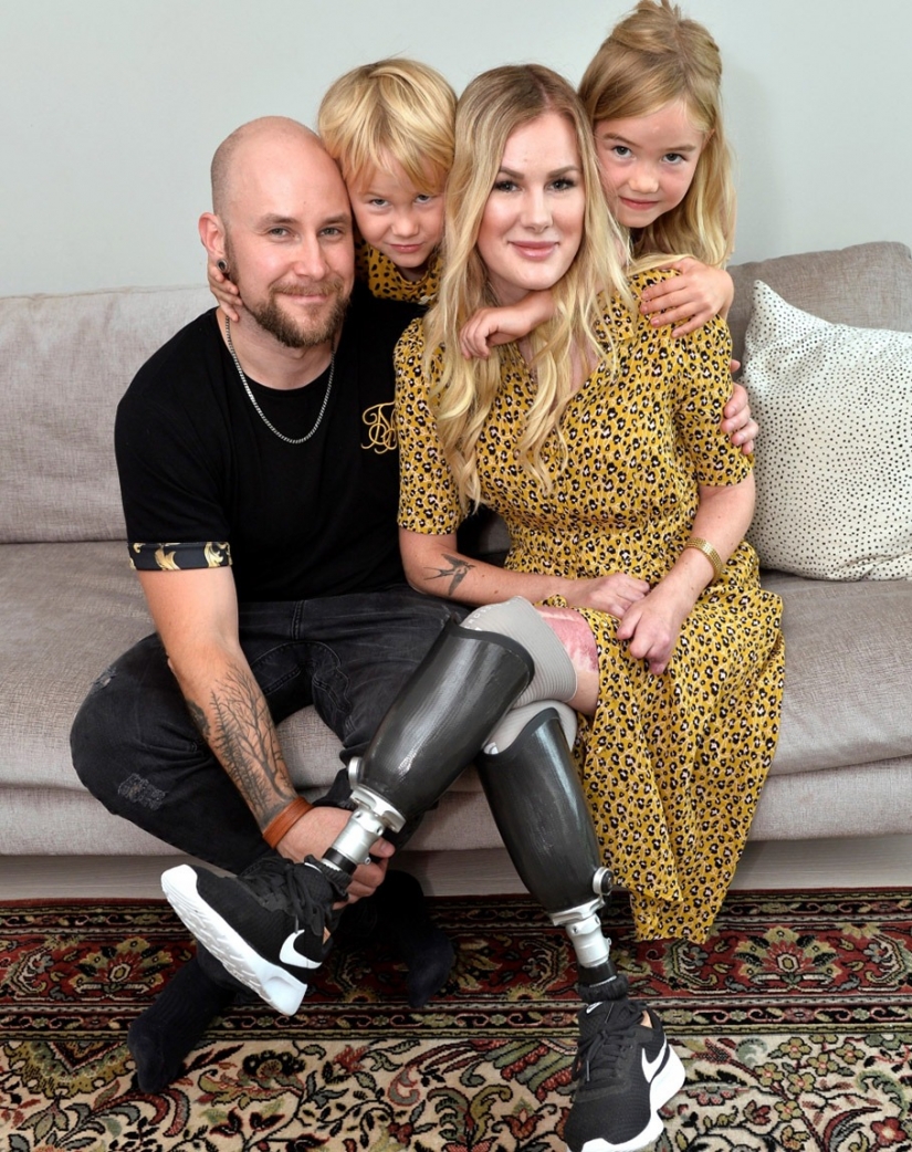 No legs, but with the will to survive: how a young mother lost a limb, but has not lost the power of the spirit No legs, but with the will to survive: how a young mother lost a limb, but has not lost the power of the spirit