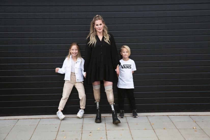 No legs, but with the will to survive: how a young mother lost a limb, but has not lost the power of the spirit No legs, but with the will to survive: how a young mother lost a limb, but has not lost the power of the spirit