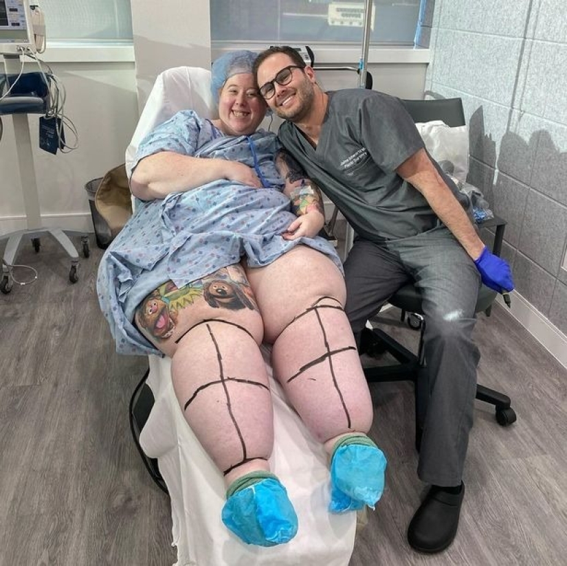 Not overeating, but a disease: an American woman is struggling with lipedema with the help of operations Not overeating, but a disease: an American woman is struggling with lipedema with the help of operations