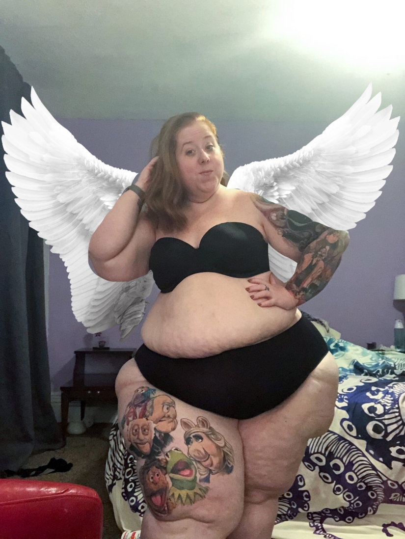 Not overeating, but a disease: an American woman is struggling with lipedema with the help of operations Not overeating, but a disease: an American woman is struggling with lipedema with the help of operations