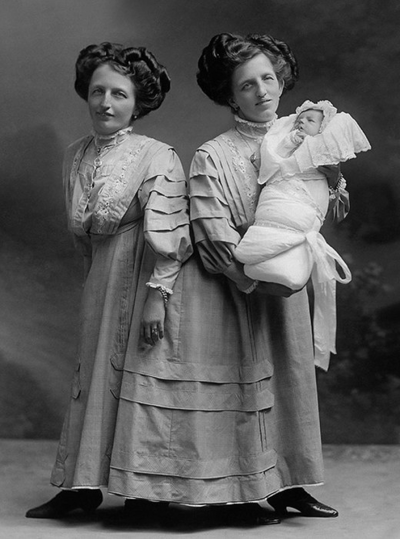 One life for two people without strain and tragedies: a happy Siamese twins One life for two people without strain and tragedies: a happy Siamese twins