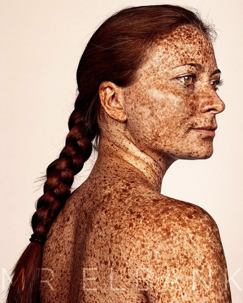 People with freckles are adorable