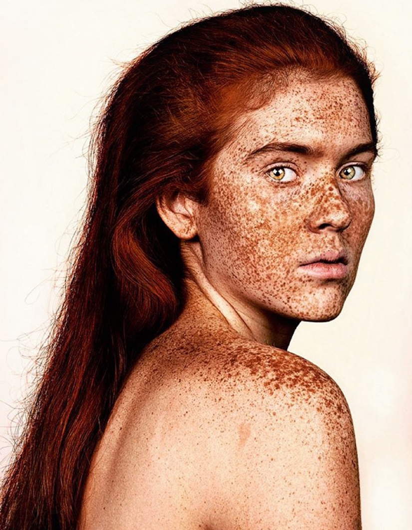 People with freckles are adorable