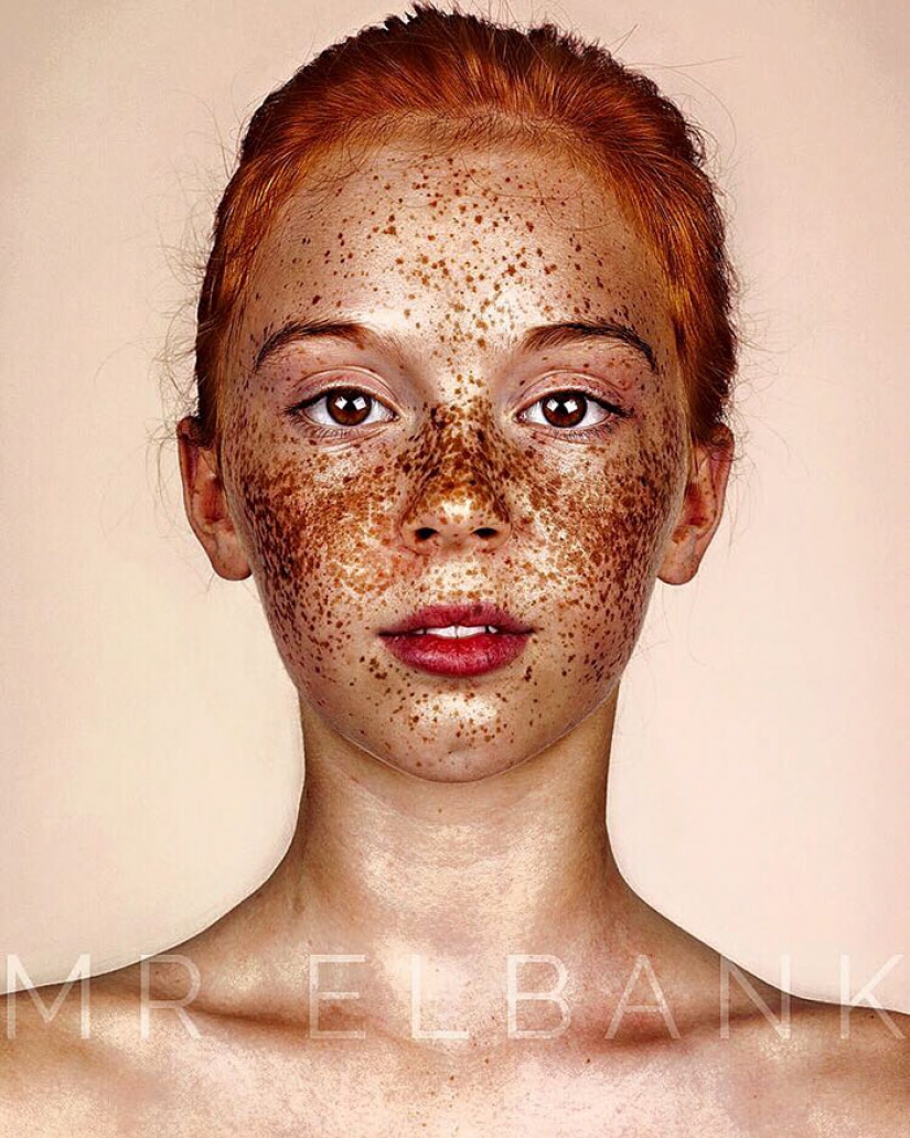 People with freckles are adorable