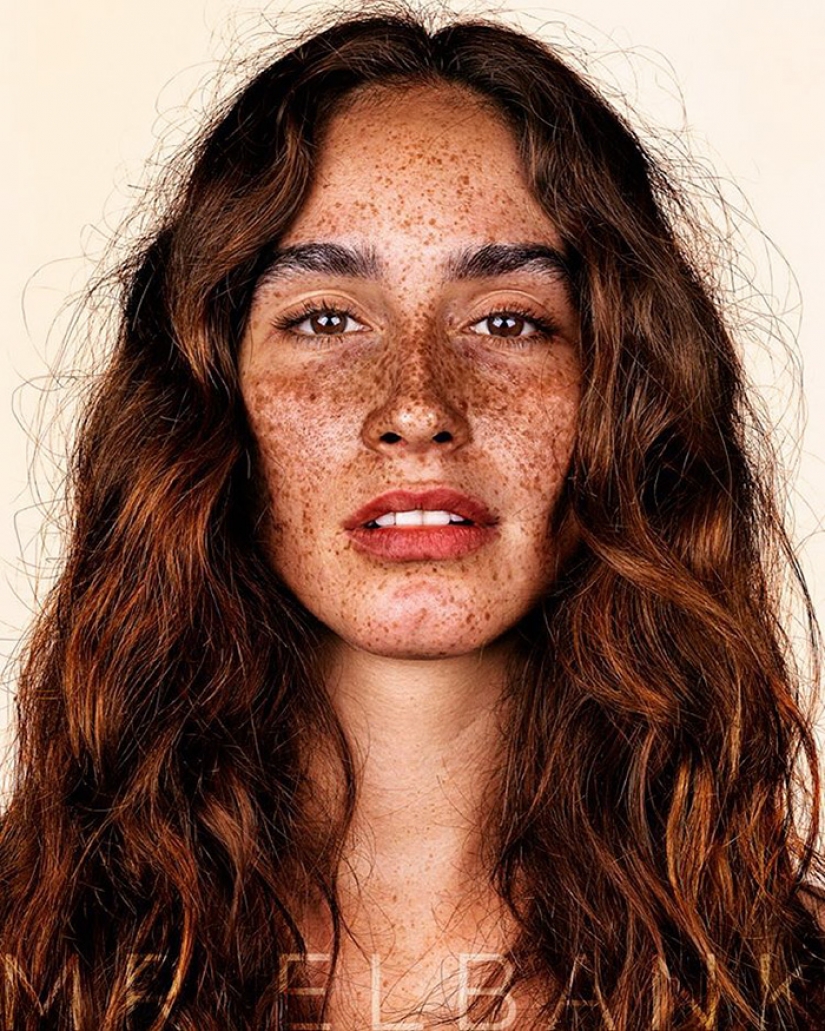 People with freckles are adorable