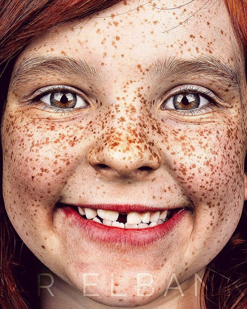 People with freckles are adorable