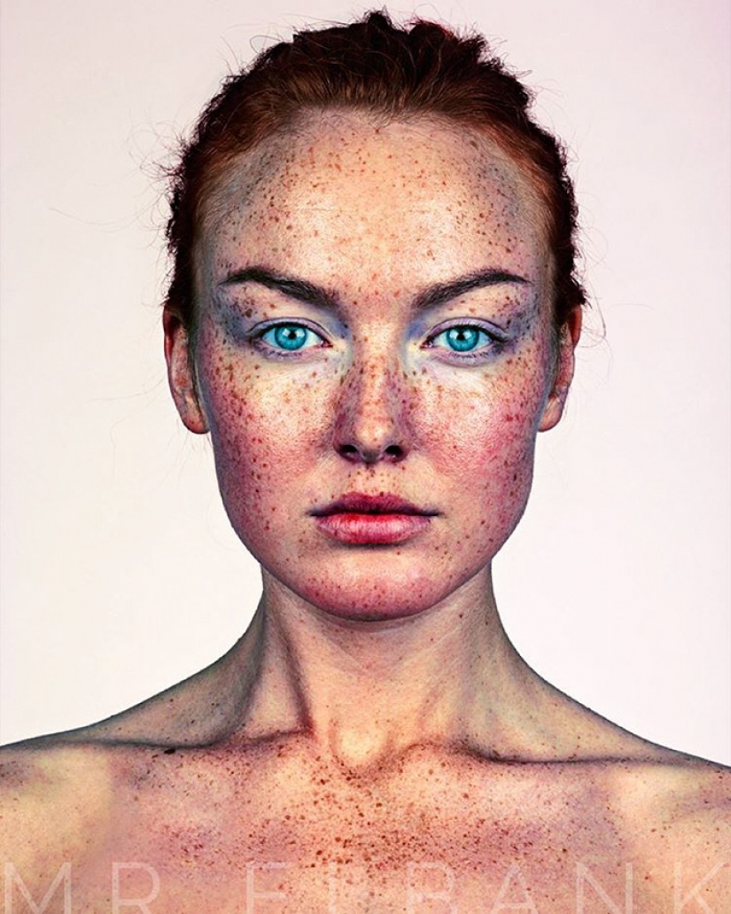 People with freckles are adorable