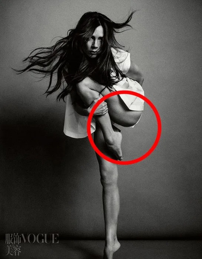 Retoque, escocés y botox: cómo las estrellas engañan a sus fans