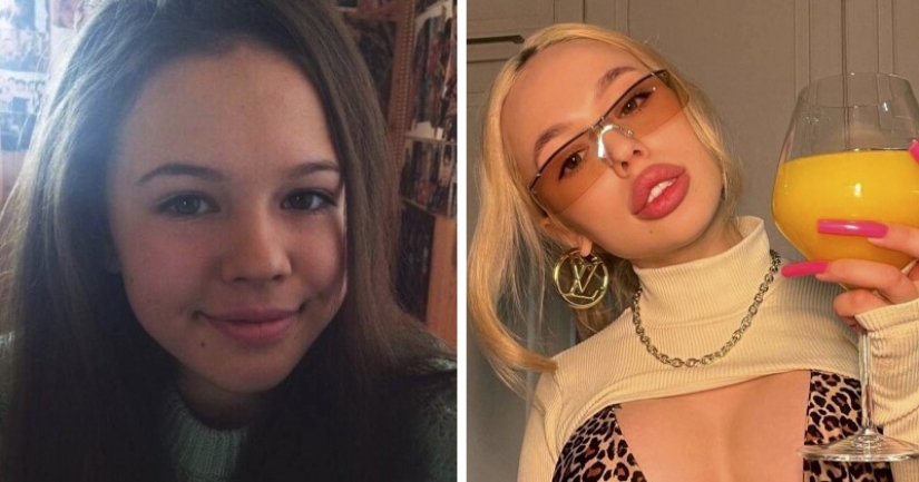 Scandalous blogger Instasamka showed her photos before plastic surgery