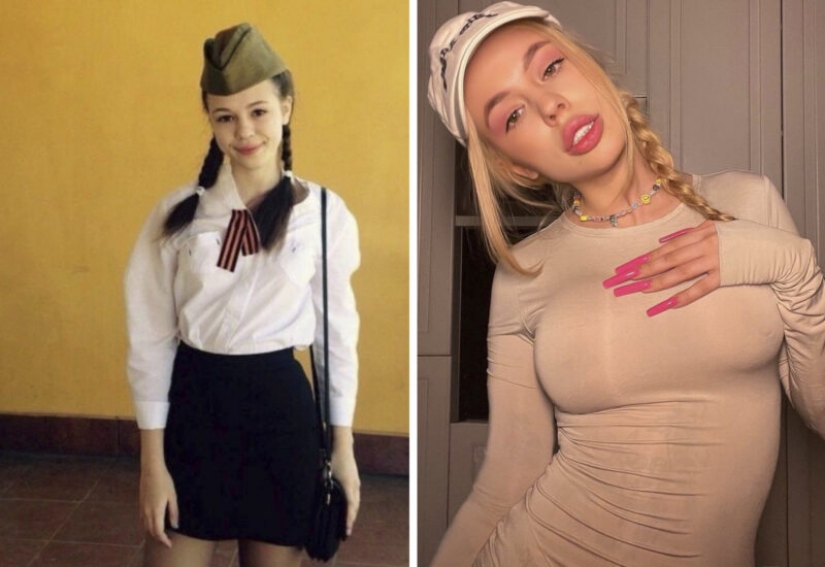 Scandalous blogger Instasamka showed her photos before plastic surgery