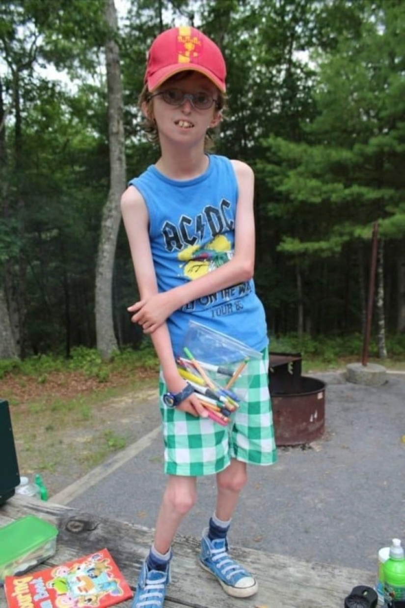 Ser quien eres: Un chico de Escocia con una enfermedad rara inspira a otros Ser quien eres: Un chico de Escocia con una enfermedad rara inspira a otros