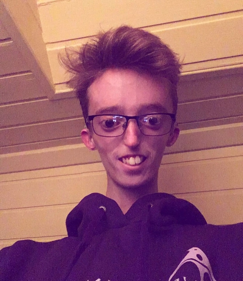 Ser quien eres: Un chico de Escocia con una enfermedad rara inspira a otros Ser quien eres: Un chico de Escocia con una enfermedad rara inspira a otros