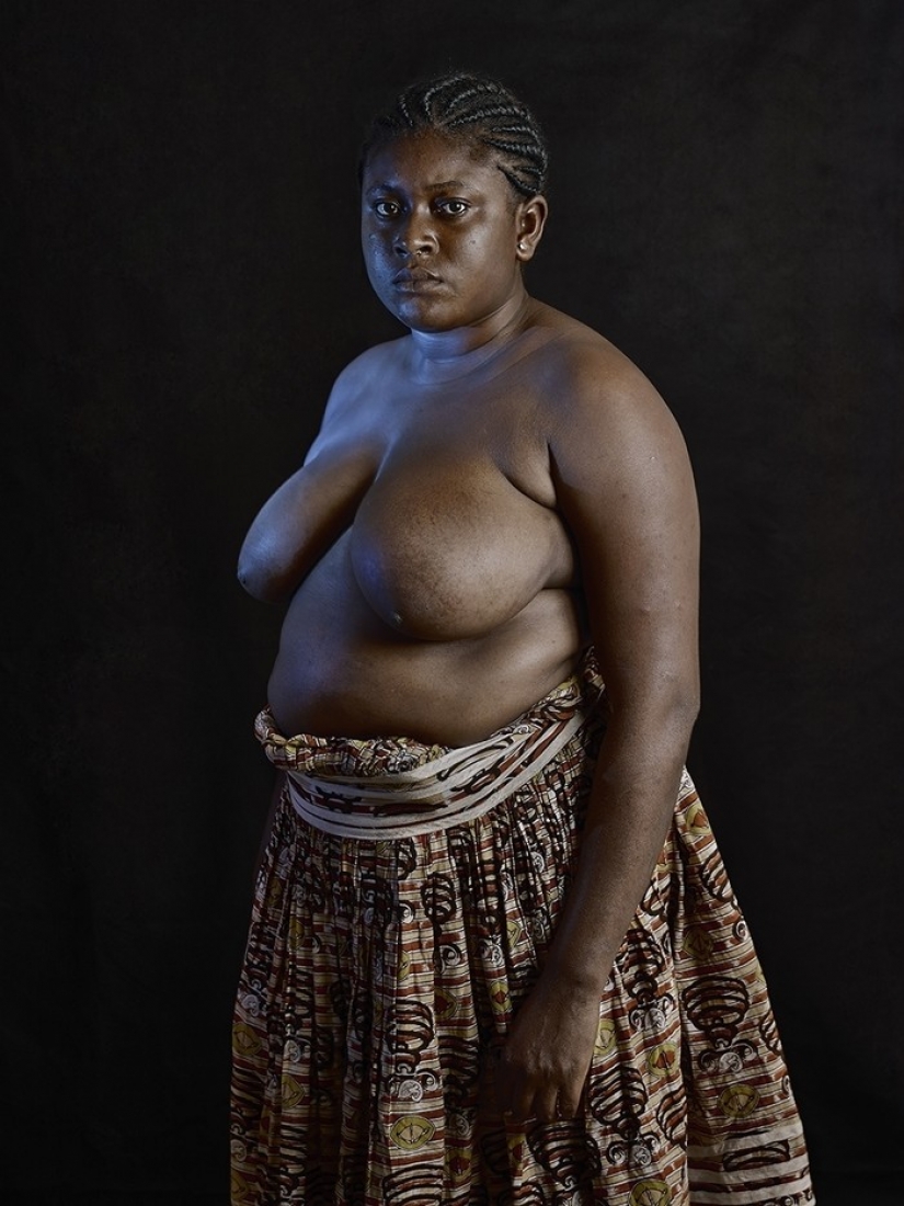 Shocking tradition of Cameroon-breast ironing