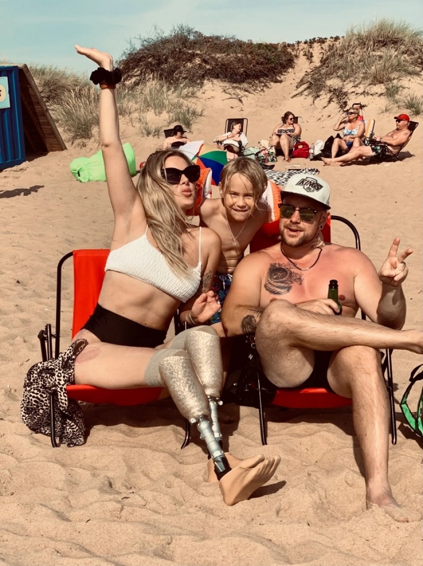 Sin piernas, pero con la voluntad de sobrevivir: ¿cómo una madre joven perdido una extremidad, pero no ha perdido el poder del espíritu